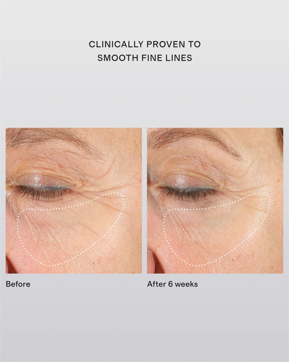Repair Serum NAC Y²™ by 111SKIN - One Size / No Color