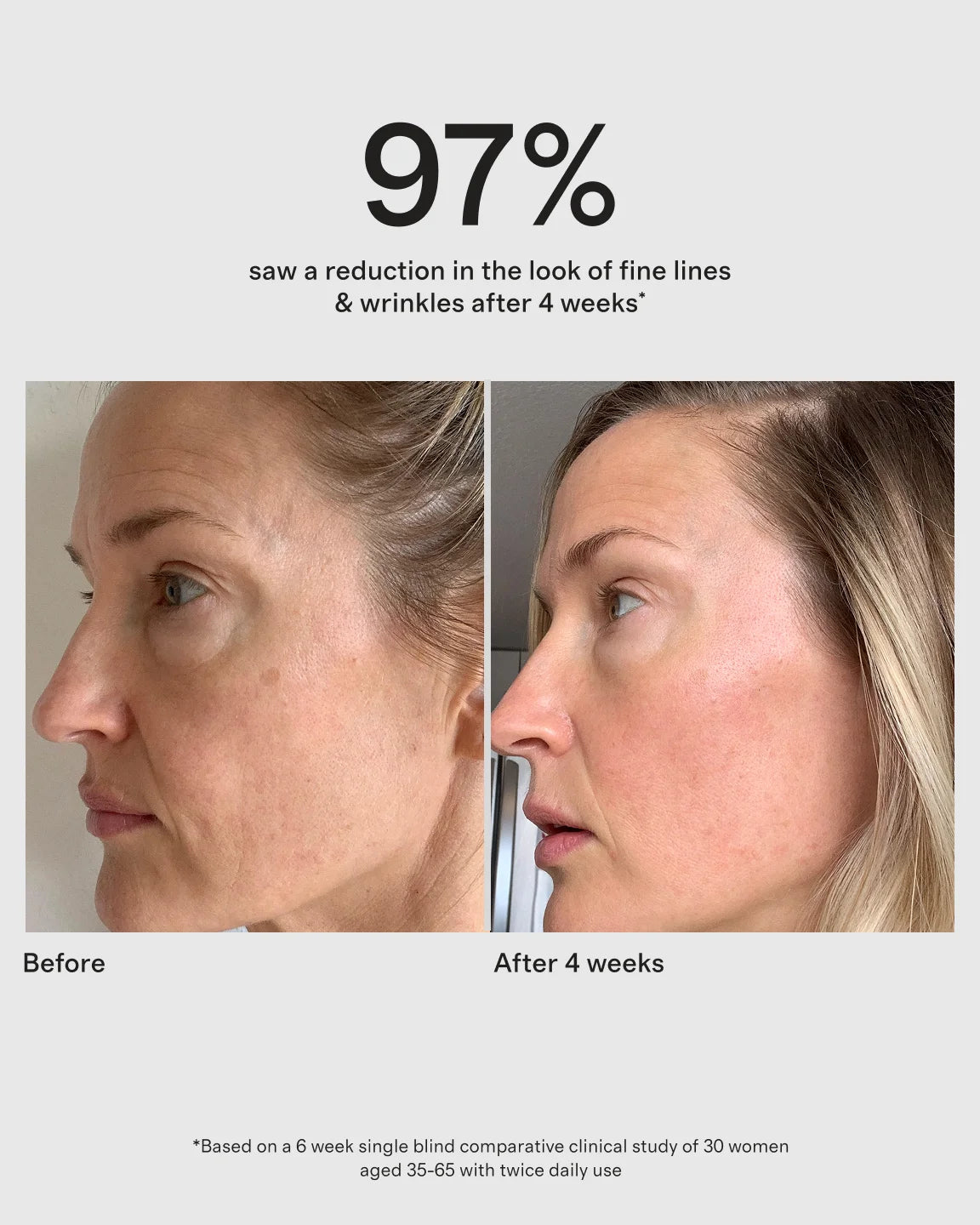 Chebula Active Serum by True Botanicals - One Size / No Color
