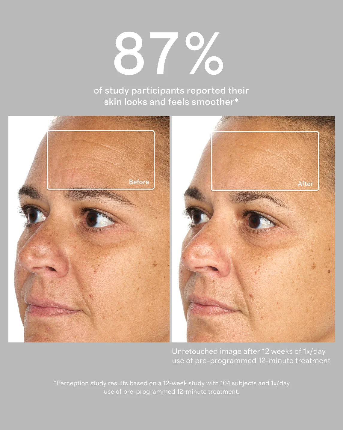 TheraFace Mask Glo by Therabody - One Size / No Color