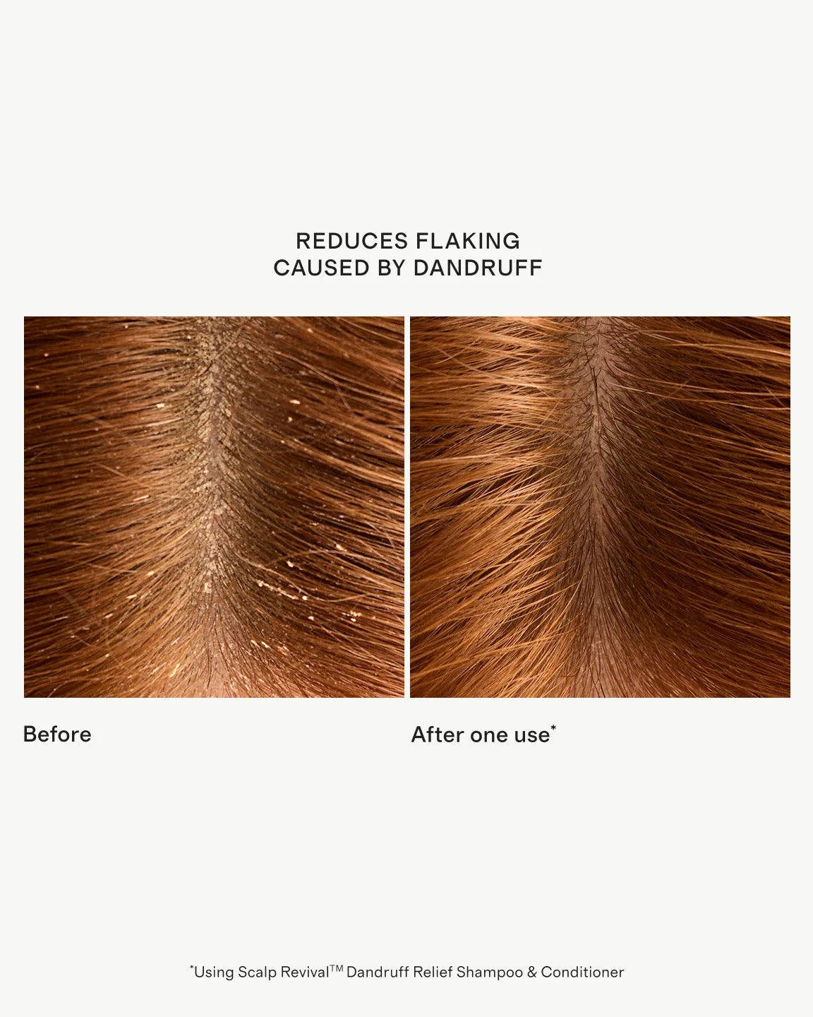 Scalp Revival™ Dandruff Relief Conditioner 8.4oz by Briogeo - One Size / No Color