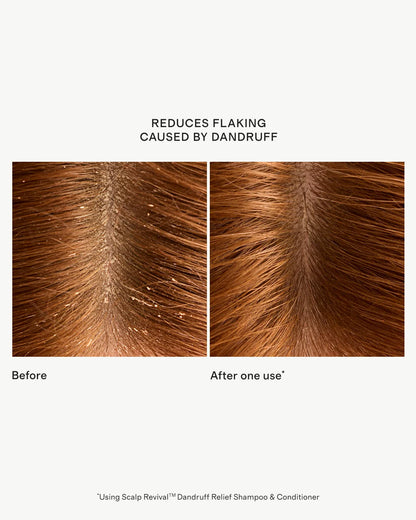 Scalp Revival™ Dandruff Relief Conditioner 8.4oz by Briogeo - One Size / No Color